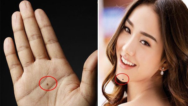 5 nốt ruồi ẩn chứa tài lộc, ai sở hữu sướng như "bắt được vàng" 5 not ruoi an chua tai loc, ai so huu suong nhu