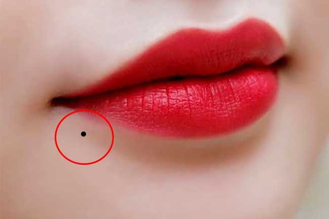 5 not ruoi xuat hien tren khuon mat la diem bao xui xeo-Hinh-5