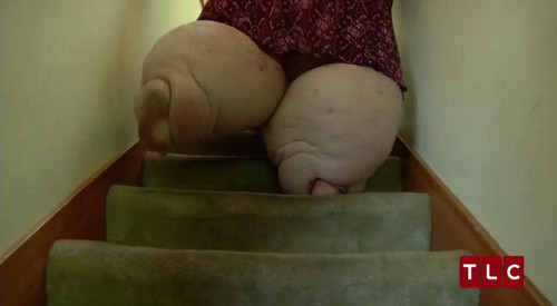 Amber thừa nhận đã hại chính mình khi ăn quá nhiều. Thân hình quá béo khiến cô luôn bị đau lưng và bắp chân.