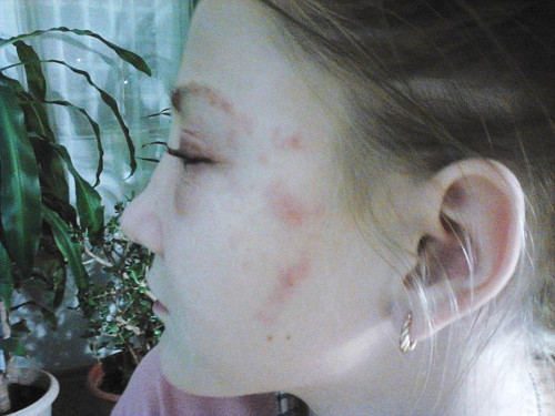 Theo một chuyên gia thẩm mỹ thì nếu không sử dụng đúng cách trộn màu các hóa chất thì rất dễ gây những hậu quả nghiêm trọng cho sức khỏe.