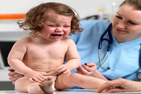 4. Trên da trẻ xuất hiện các nốt ban bất thường. Đây cũng là một trong những triệu chứng nguy hiểm ở trẻ. Nếu mẹ thấy trên da bé xuất hiện những vết ban trên diện rộng mà không giải thích được nguyên nhân thì bé cần được gặp khám bác sĩ ngay lập tức.