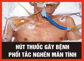 2. Hút thuốc lá gây bệnh phổi tác nghẽn mãn tính