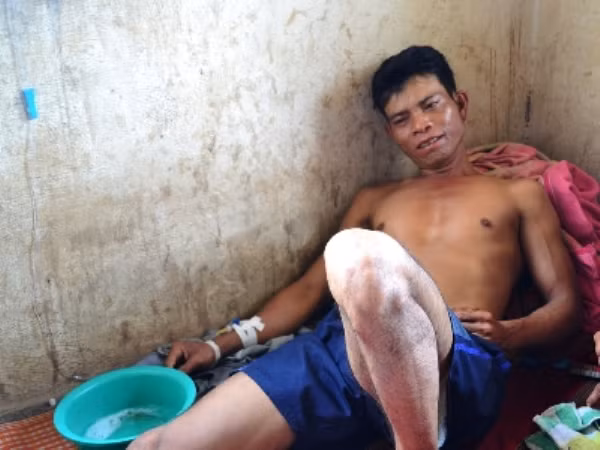 Y BRung lúc đang còn sống.