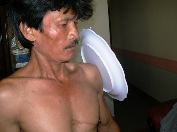 Anh Khải với khả năng siêu nhiên có thể hút mọi vật vào cơ thể.