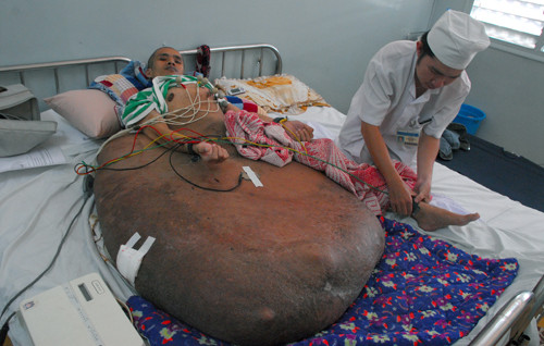 Anh Hải lúc chuẩn bị phẫu thuật