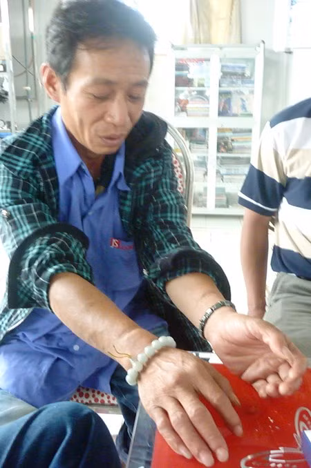 Anh Lương nay đã khỏi hẳn nhưng vết sẹo ở chân tay do bị xích vẫn còn in rõ.