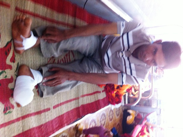 Nạn nhân Y Kút Ayul điều trị tại bệnh viện.