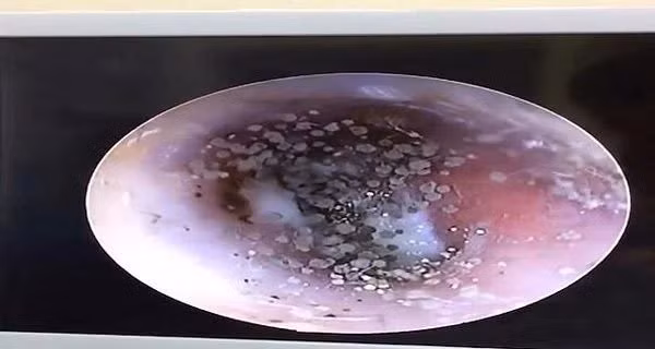 Kinh hoang phat hien day nam trong tai vi thoi quen pho bien nay