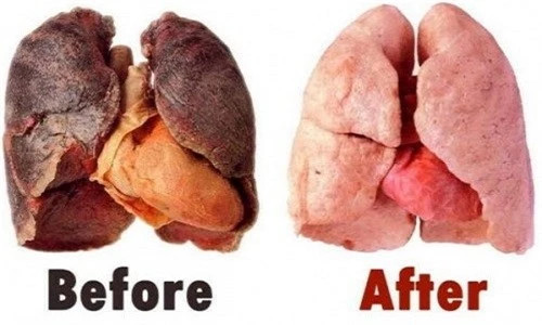 Một số loại thực phẩm, đồ uống giúp làm sạch phổi Mot so loai thuc pham, do uong giup lam sach phoi