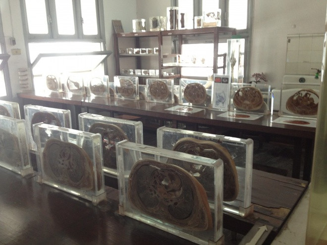  8. Bảo tàng Y học Siriraj, Bangkok, Thái Lan: Khu tổ hợp này gồm 5 bảo tàng với chủ đề từ ký sinh trùng cho tới pháp y. Bảo tàng Ký sinh trùng có từ con sán siêu dài tới tinh hoàn người bị chứng phù voi, sưng phồng lên và nặng tới 35 kg. Bảo tàng Pháp y trưng bày xác của các nạn nhân tai nạn, kẻ sát nhân hàng loạt và nội tạng.