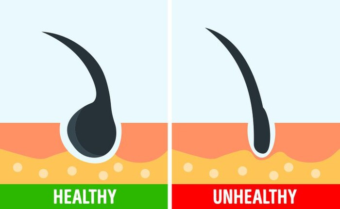 4 cach giup ban kiem tra suc khoe cua toc trong mua hanh kho