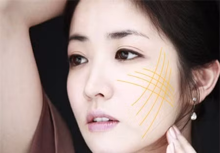 Với chỉ vàng 24K được quảng cáo thật ra là loại chỉ bằng vàng nano được dùng trong ngành y tế.