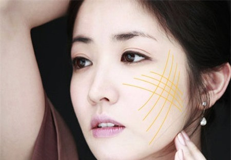 Với chỉ vàng 24K được quảng cáo thật ra là loại chỉ bằng vàng nano được dùng trong ngành y tế.