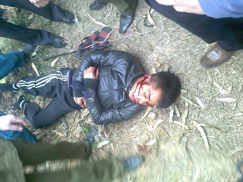 Đối tượng trộm chó bị đánh trọng thương.