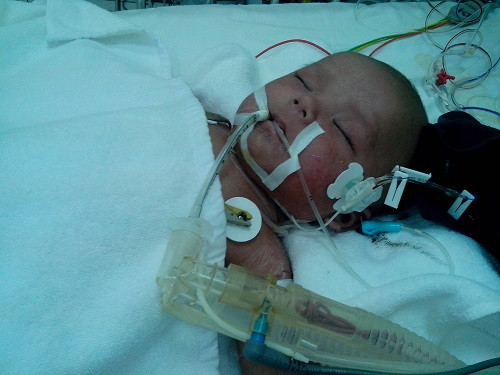 Dịch sởi đang là mối lo cho nhiều người.