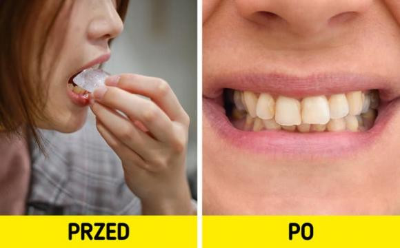 6 cach tay trang rang an toan-Hinh-2