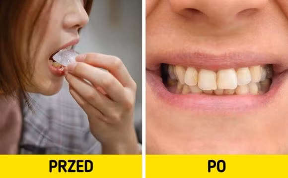 6 cach tay trang rang an toan-Hinh-2