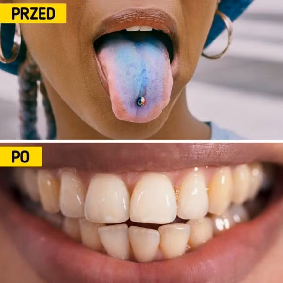 6 cach tay trang rang an toan-Hinh-3