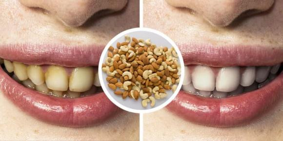 6 cach tay trang rang an toan-Hinh-4