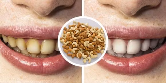 6 cach tay trang rang an toan-Hinh-4