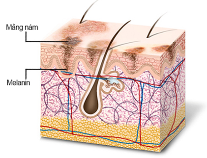 Melanin – “thủ phạm” khiến làn da sạm, nám. (Ảnh minh họa).