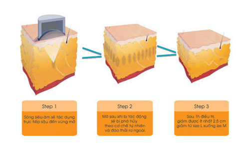 Lượng mỡ thừa dưới tác động của nguồn năng lượng từ công nghệ Liposonix.