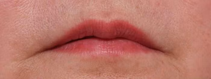 br/> Miệng thuyền úp: Trong nhân tướng học những người phụ nữ có tướng này thuộc tuýp người có cuộc sống thường gặp nhiều lận đận khó giàu có như ý muốn. 