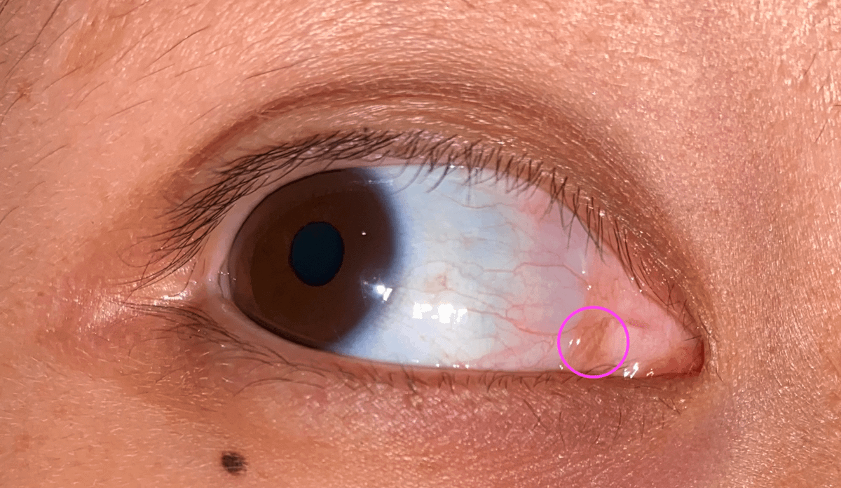 Vì sao nhiều loài động vật có mí mắt thứ ba, con người thì không? - Hình 5 Vi sao nhieu loai dong vat co mi mat thu ba, con nguoi thi khong?-Hinh-5