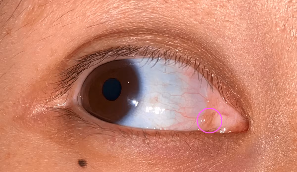 Vi sao nhieu loai dong vat co mi mat thu ba, con nguoi thi khong?-Hinh-5