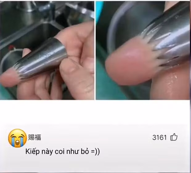 Thanh nien suyt mat ngon tay chi vi nghich ngom khi lam banh-Hinh-2