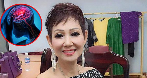 6 biểu hiện cảnh báo đột quỵ sớm ở nữ giới không được bỏ qua 6 bieu hien canh bao dot quy som o nu gioi khong duoc bo qua