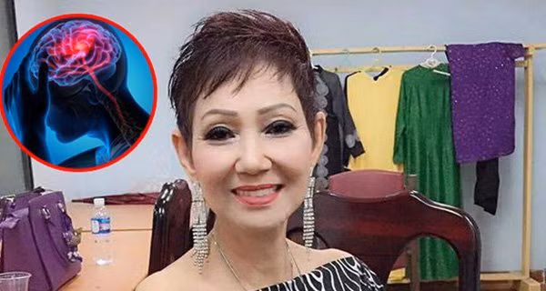 6 bieu hien canh bao dot quy som o nu gioi khong duoc bo qua