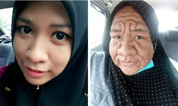 Nguoi phu nu 28 tuoi bong choc lao hoa nhu ba cu 80