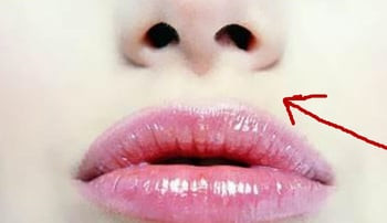 4 biểu hiện trên mặt chứng tỏ nữ giới bị viêm nhiễm phụ khoa - Hình 3 4 bieu hien tren mat chung to nu gioi bi viem nhiem phu khoa-Hinh-3