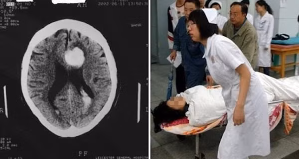 Vo keu dau dau roi ngu, ngung tho chong khong biet