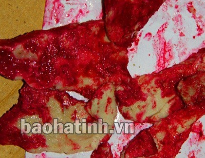 Thịt lợn đổi sang màu đỏ quạch.