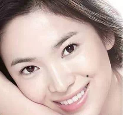 6. Nốt ruồi trên mặt trái: Phúc khí. Người có nốt ruồi ở má trái thường gặp nhiều may mắn, nhưng họ thường bỏ lỡ cơ hội để phát triển bản thân.