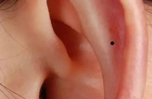  9. Nốt ruồi ở trong tai: Sống thọ. Nốt ruồi ở trong tai là biểu hiện của việc bạn sẽ có tuổi thọ lâu dài.