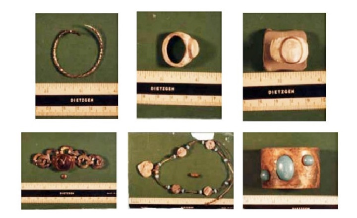 Ga 'tho banh do te' voi thu vui san nguoi benh hoan-Hinh-2