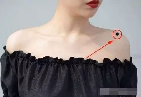 5 not ruoi may man tren co the khong bao gio duoc xoa bo-Hinh-3