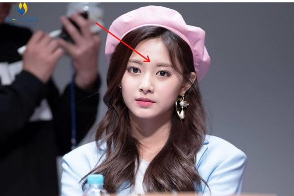 Người mà Ấn Đường bị che khuất sẽ tạo cảm giác Ấn Đường nhỏ hẹp, khiến cho lòng dạ trở nên hẹp hòi, cũng chẳng dám mơ ước gì cao xa. Họ lúc nào cũng rơi vào cảnh thiếu thốn tiền bạc bởi vận tài lộc chẳng có là bao, cả đời cũng khó làm nên chuyện gì to tát. 