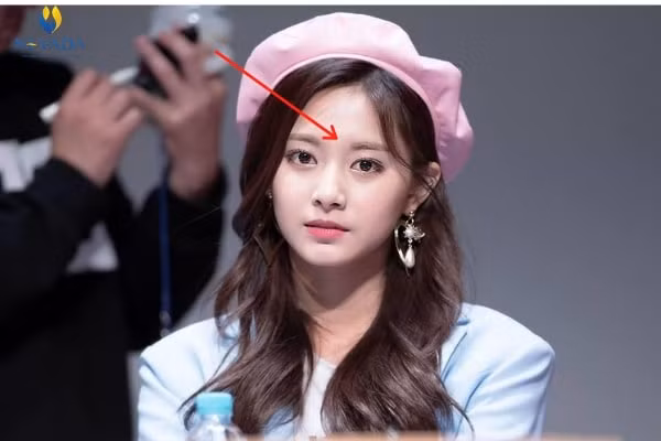 Người mà Ấn Đường bị che khuất sẽ tạo cảm giác Ấn Đường nhỏ hẹp, khiến cho lòng dạ trở nên hẹp hòi, cũng chẳng dám mơ ước gì cao xa. Họ lúc nào cũng rơi vào cảnh thiếu thốn tiền bạc bởi vận tài lộc chẳng có là bao, cả đời cũng khó làm nên chuyện gì to tát. 