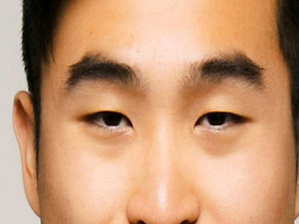 Sở dĩ nói vậy vì người này làm việc lúc nào cũng đơn thương độc mã, chẳng thể hợp tác cùng ai. Họ nông nổi và bốc đồng, không cân nhắc xem xét kỹ hậu quả hành động của mình, cũng chẳng hề ngần ngại mà phản bội bạn bè, hãm hại người khác. Có lúc đó là hành động có chủ đích, song có lúc lại là do họ thiếu suy nghĩ mà chẳng hề để tâm đến những việc đó, chẳng thế mà cổ nhân xét về tướng số lại nói đây là tướng người hại người hại cả thân mình, cuối cùng đều bị bạn bè xa lánh.