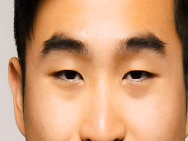 Sở dĩ nói vậy vì người này làm việc lúc nào cũng đơn thương độc mã, chẳng thể hợp tác cùng ai. Họ nông nổi và bốc đồng, không cân nhắc xem xét kỹ hậu quả hành động của mình, cũng chẳng hề ngần ngại mà phản bội bạn bè, hãm hại người khác. Có lúc đó là hành động có chủ đích, song có lúc lại là do họ thiếu suy nghĩ mà chẳng hề để tâm đến những việc đó, chẳng thế mà cổ nhân xét về tướng số lại nói đây là tướng người hại người hại cả thân mình, cuối cùng đều bị bạn bè xa lánh.