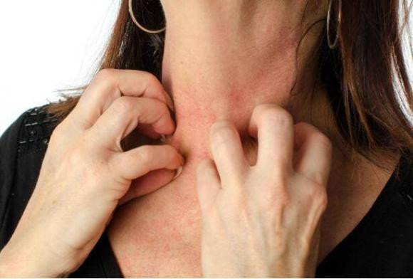 Gan khong tot se xuat hien 4 loai “di tat” ve da