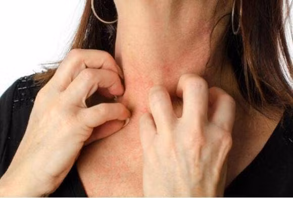 Gan khong tot se xuat hien 4 loai “di tat” ve da