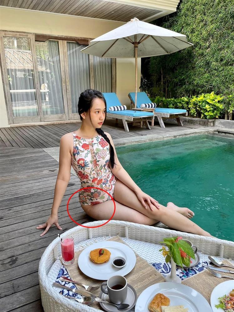 Truc Anh 'Mat Biec' bi soi dui chang chit vet ran hau tang 8kg