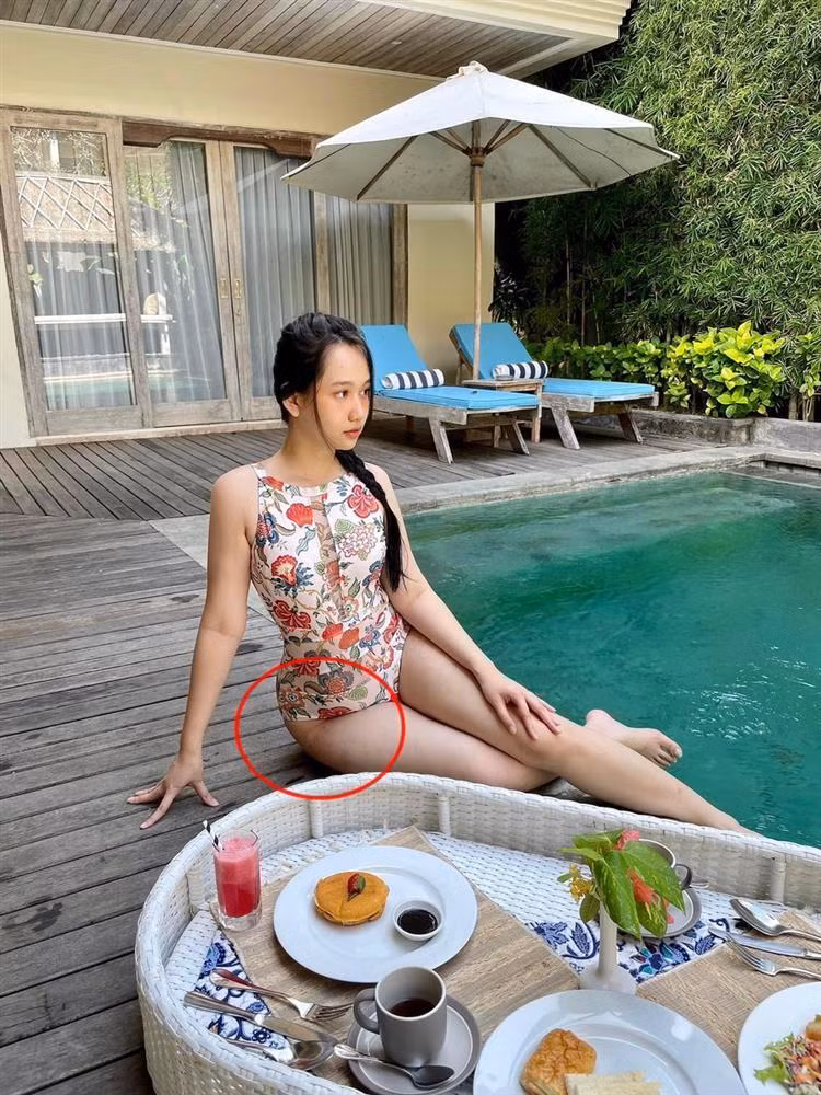 Truc Anh 'Mat Biec' bi soi dui chang chit vet ran hau tang 8kg