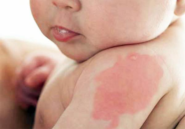 Khi mang thai me bau nho lam dieu nay de con sinh ra khong co vet bot