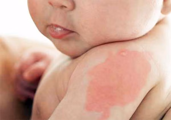 Khi mang thai me bau nho lam dieu nay de con sinh ra khong co vet bot